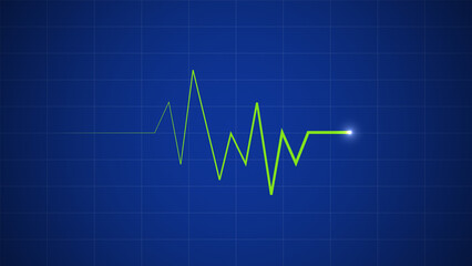 Heartbeat frequency on heart line monitor recording pulse