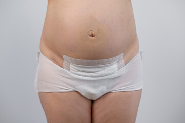 Close-up of a woman's belly after a caesarean section. 