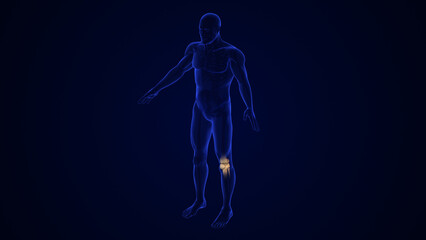 Obraz premium Broken Patella Bone medical concept