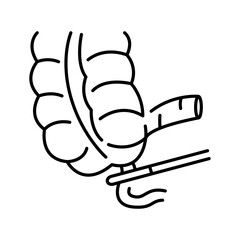 Obraz premium Appendectomy line black icon.
