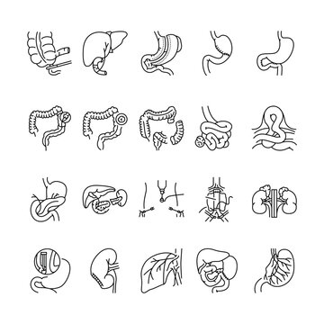 Operations on the abdominal cavity line black icons set.