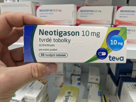 Prague, Czech Republic - July 10 2024: NEOTIGASON TEVA box of medication with ACITRETIN active substance by TEVA, used for treatment of severe psoriasis and skin disorders.

