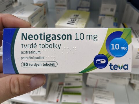 Prague, Czech Republic - July 10 2024: NEOTIGASON TEVA box of medication with ACITRETIN active substance by TEVA, used for treatment of severe psoriasis and skin disorders.

