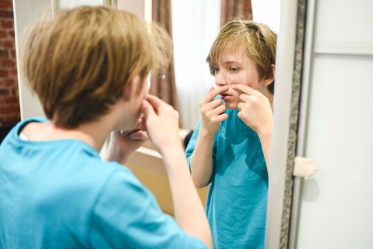 teenage boy looks at his face in the mirror, squeezes out a pimple.