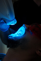 Man patient receives teeth whitening in dental clinic. Teeth whitening apparatus applying by...
