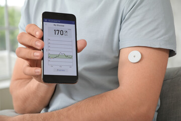 Diabetic young man with glucose sensor and mobile phone measuring blood sugar level at home, closeup