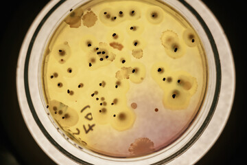 Close up focused view of Trichoderma in the rounded lab container