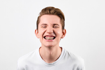 Obraz premium A young man with braces on his teeth smiling while looking directly at the camera. His braces are clearly visible and he appears happy