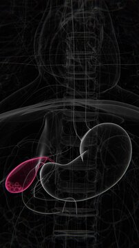 Stones in Gall Bladder Vertical Video | Stones in Gall Bladder Vertical indication Animation vertical video in HD