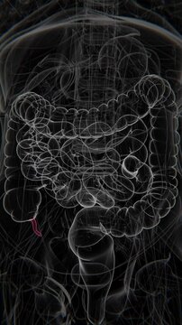 Appendicitis Vertical Video | appendix Animation Concept Video | appendix in Human Animation vertical video HD