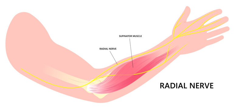 Anatomy of Radial tunnel syndrome with compressed nerve of Tinel's and Golfer's disease
