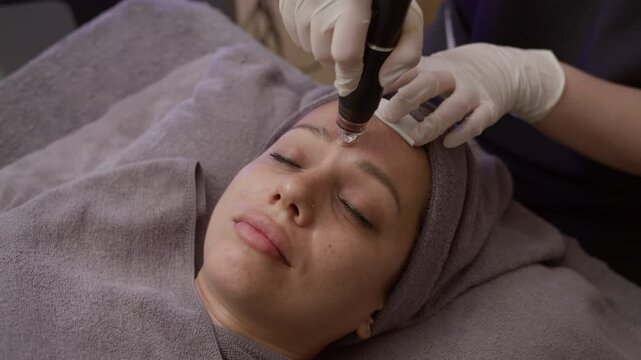 Close up of Caucasian woman getting anti-wrinkle treatment on her face during microneedling procedure at clinic