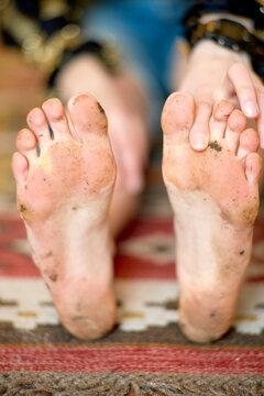 Bare, dirty feet with visible toes of a person resting on a colorful, patterned rug.