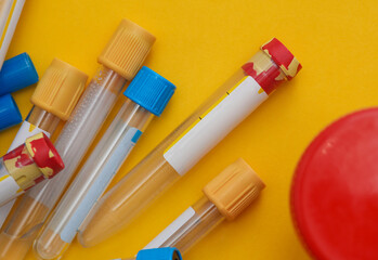 Medical test tubes and jar for tests on yellow background