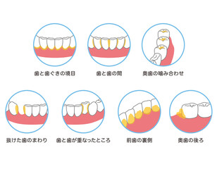 歯に溜まった歯垢　歯磨き　磨き残し