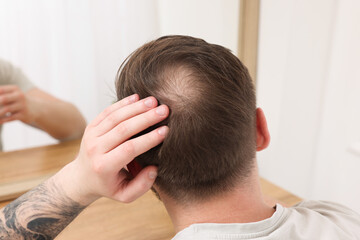 Baldness concept. Man with bald spot looking at mirror indoors, back view