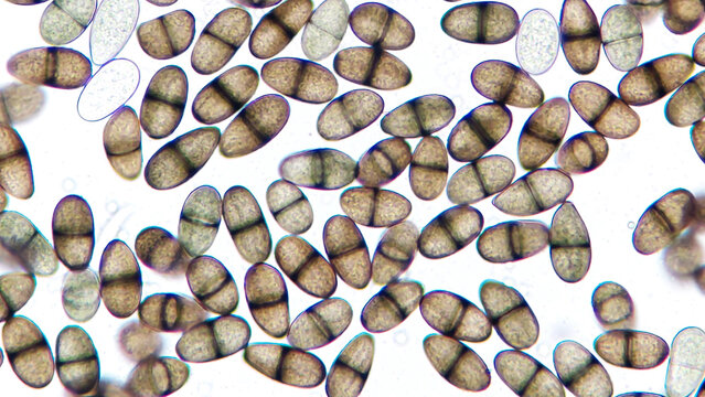 Lasiodiplodia sp. mature conidia. This fungi grow on Pachyrhizus erosus tuber. 400x magnification + 3.5x camera zoom. Live cell. Selective focus image
