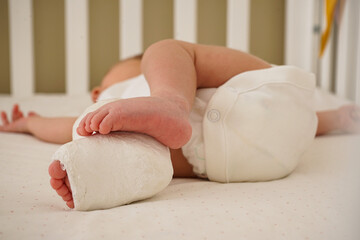 Newborn little baby with leg in a cast - clubfoot, close-up.