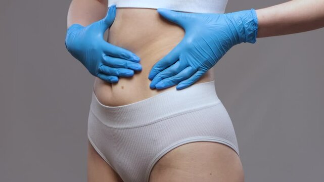Girl pulls the skin on the abdomen and on the hips showing the body fat. Treatment and disposal of excess weight, the deposition of subcutaneous fat.