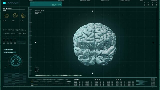 Medical Scanning Software. CT Scan of the brain tumor of the Patient. Analyzing the Brain Tumor for the Scientific Research. Brain Tumor is being studied in the tomography machine. Laboratory. UI.