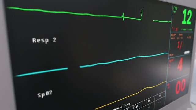 Device displaying the heartbeat graph of the sick patient at the hospital. Indicating the flatline heartbeat graph of a clinic patient. Heartbeat graph signifying the death of hospital patient.