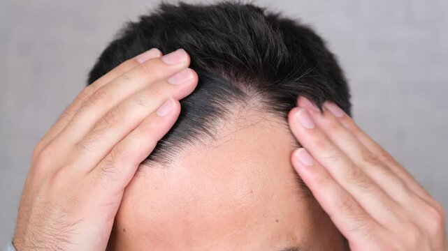 suffering hair loss