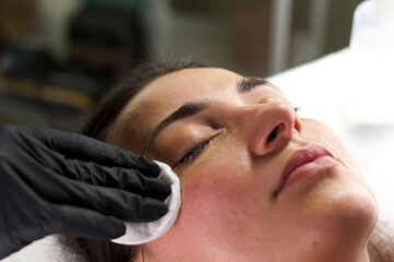 Fototapeta premium A beautician wearing black gloves cleanses a woman's face with a cotton pad after applying a skincare product. The image showcases the importance of post-treatment care.