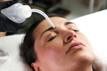 A beautician wearing black gloves applies a cleansing solution to a woman's face using a dropper....