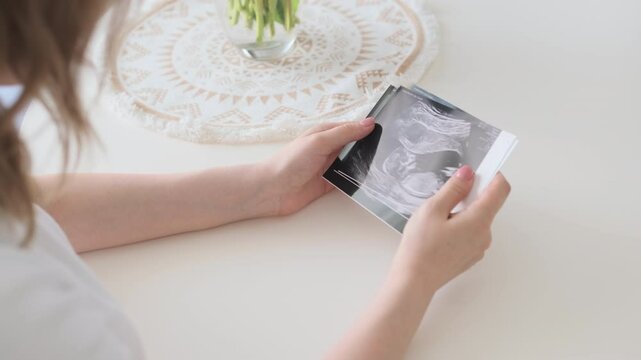 Young woman looks at pictures of future baby ultrasound examination sitting at table. Cheerful pregnant female undergoes regular prenatal checkup