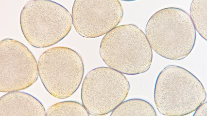 Melon (Cucumis melo) pollen grains under light microscope. Curcubitaceae pollen grains. 400x magnification + 2.8x camera zoom. Fresh sample. Selective focus image.