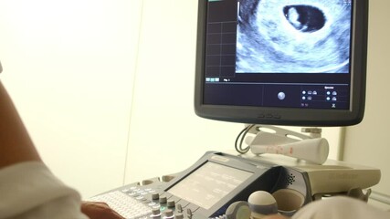 Vaginal ultrasound of a 7-8 week pregnant woman showing fetal heartbeat. Early pregnancy gynecological examination