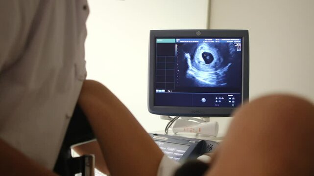 Vaginal ultrasound of a 7-8 week pregnant woman showing a clear fetal heartbeat. Early pregnancy gynecological examination, ideal for medical and educational content