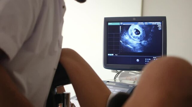 Vaginal ultrasound of a 7-8 week pregnant woman showing a clear fetal heartbeat. Early pregnancy gynecological examination, ideal for medical and educational content