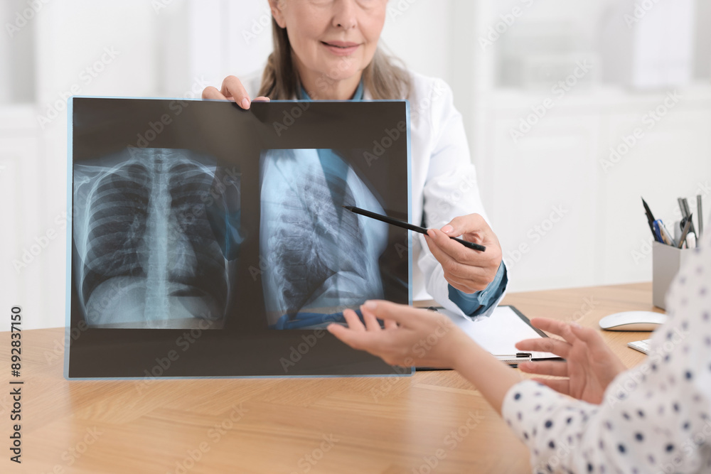 Canvas Prints Lung disease. Doctor showing chest x-ray to her patient in clinic, closeup