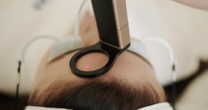 Facial rejuvenation, Close up of a young girl getting laser face treatment in a medical center, skin rejuvenation concept. mesotherapy rejuvenation with laser technology. Beauty treatment.