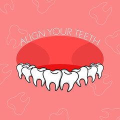 National Align Your Teeth Day event banner.  Illustration of misaligned teeth with bold text on pink background to celebrate on August 11th