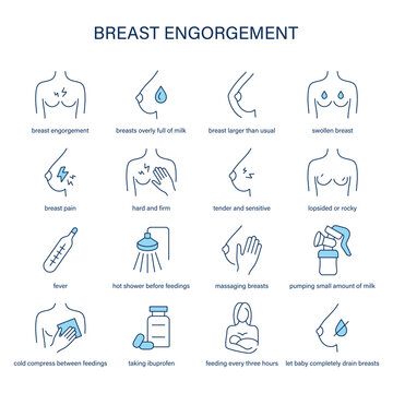 Breast Engorgement symptoms, diagnostic and treatment vector icons. Medical icons.