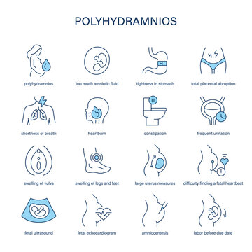Polyhydramnios symptoms, diagnostic and treatment vector icons. Medical icons.