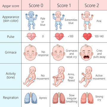 Apgar score chart evaluating the health of newborns, appearance, pulse, grimace, activity, and respiration diagram hand drawn schematic vector illustration. Medical science educational illustration