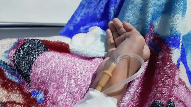 Patient suffering from leprosy and high fever lying in hospital bed with cannula in hand to receive medical treatment