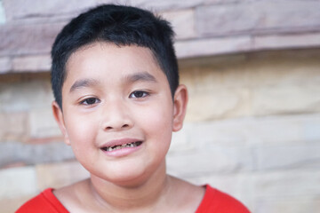 Asian boy wearing a red t-shirt, 7 years old Smiling, showing one broken upper baby tooth.