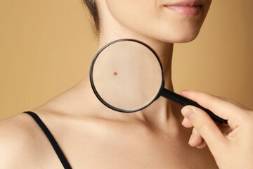 Doctor examining woman's mole with magnifying glass on beige background, closeup