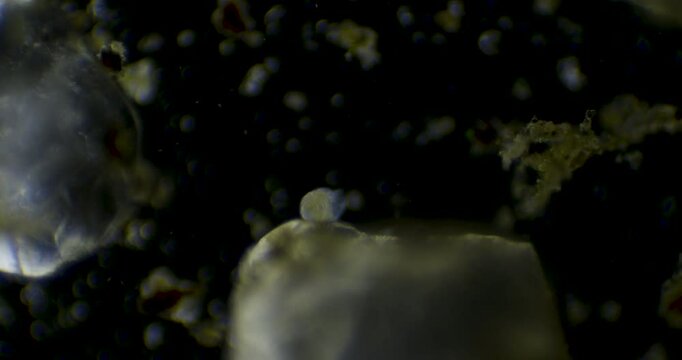 Rotifer flagellates freshwater (trichotria tetractis) under the microscope two different angles
