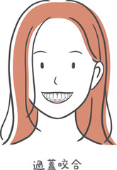 過蓋咬合の歯並びが悪い女性のイラスト素材