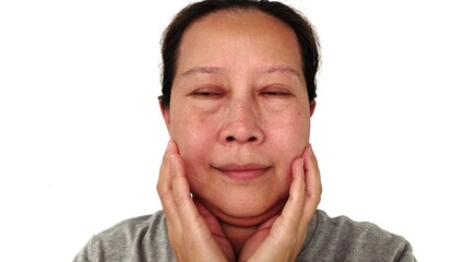 portrait of hand holding the Flabby and scar, blackhead lines and loose, Flabbiness and dark spots, emotion and expression on the face of middle aged women, health care and beauty concept.