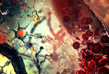 Ischemic brain stroke concept, illustration showing human brain and close-up view of blood vessel 