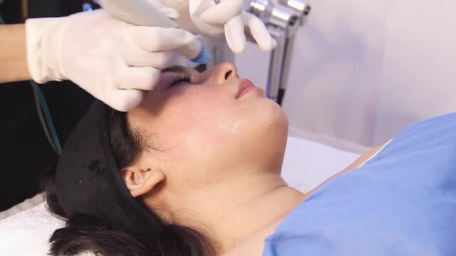 Dermatologist use HydraFacial Machine on Facial skin, Skincare session