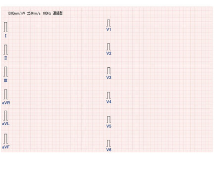 十二誘導心電図記録紙