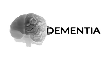 Dementia Brain Scan Concept