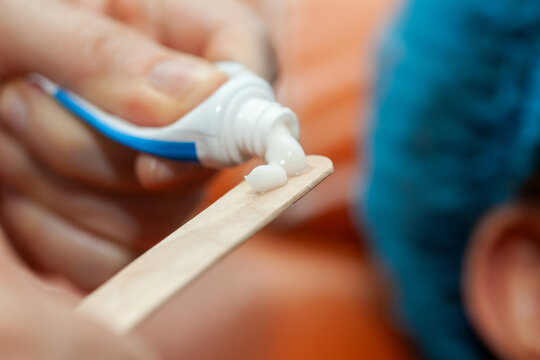 Application of topical anesthesia cream prior to a dermatological procedure.